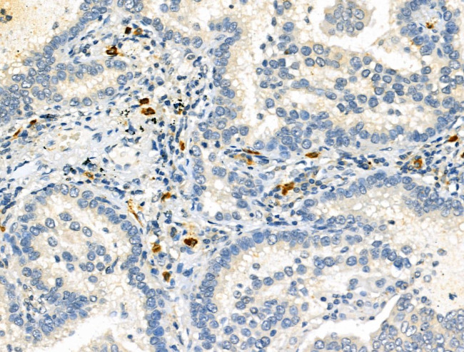 SEPT9 Antibody in Immunohistochemistry (Paraffin) (IHC (P))