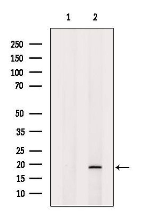 SNAPAP Antibody in Western Blot (WB)