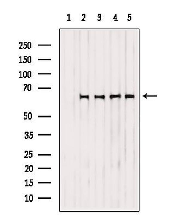 SPTLC2 Antibody in Western Blot (WB)