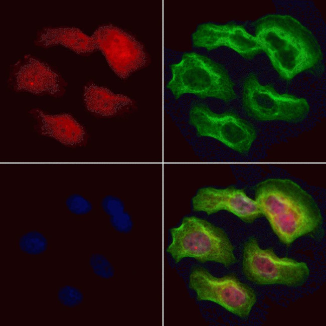 SRP68 Antibody in Immunocytochemistry (ICC/IF)