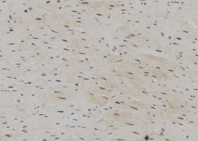 SRP68 Antibody in Immunohistochemistry (Paraffin) (IHC (P))