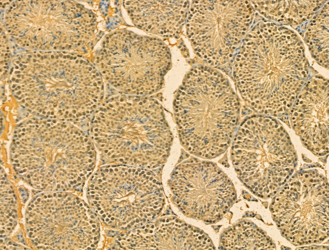 SRP68 Antibody in Immunohistochemistry (Paraffin) (IHC (P))