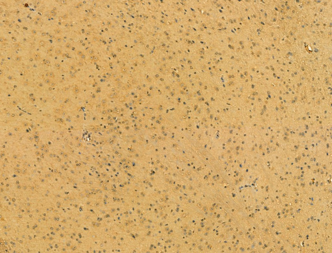 SRP68 Antibody in Immunohistochemistry (Paraffin) (IHC (P))