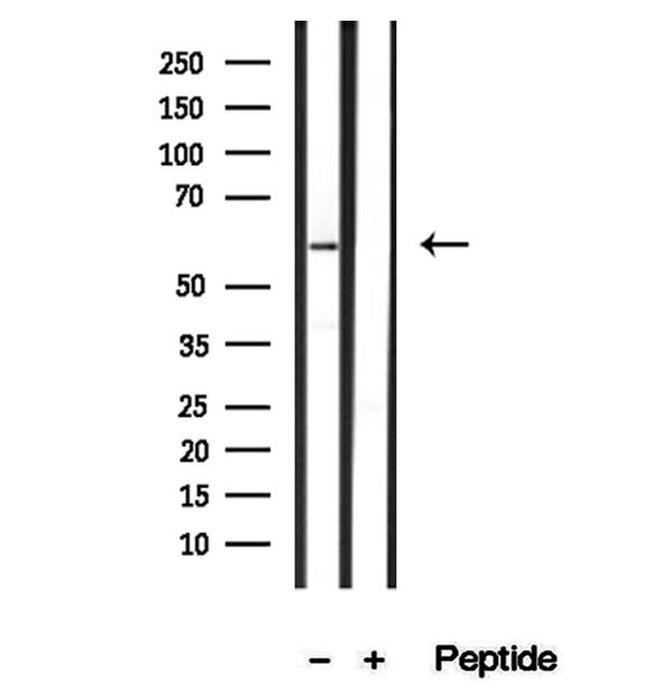 SRP68 Antibody in Western Blot (WB)