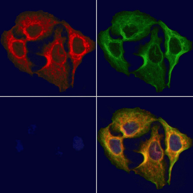 HRD1 Antibody in Immunocytochemistry (ICC/IF)