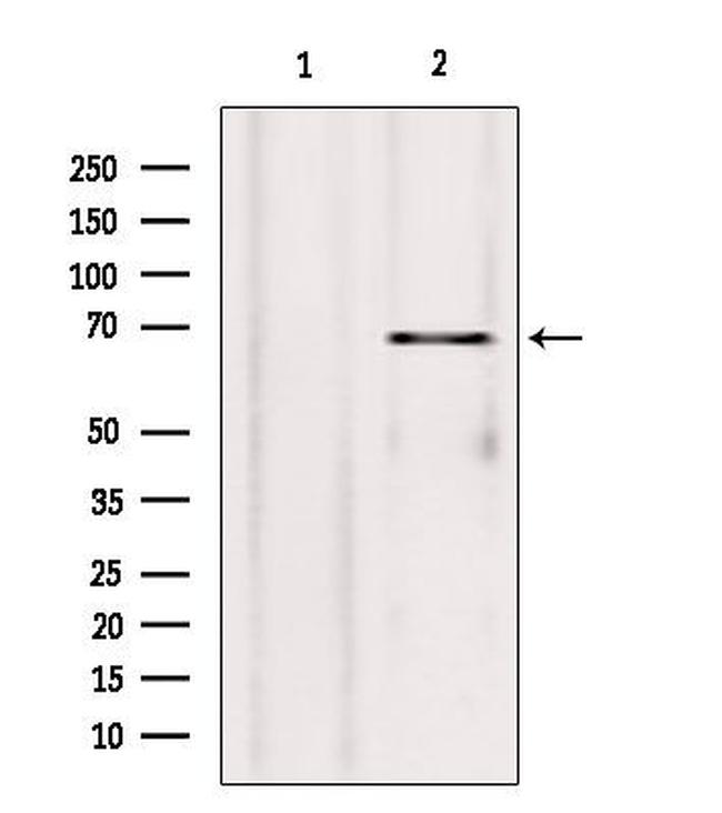 HRD1 Antibody in Western Blot (WB)