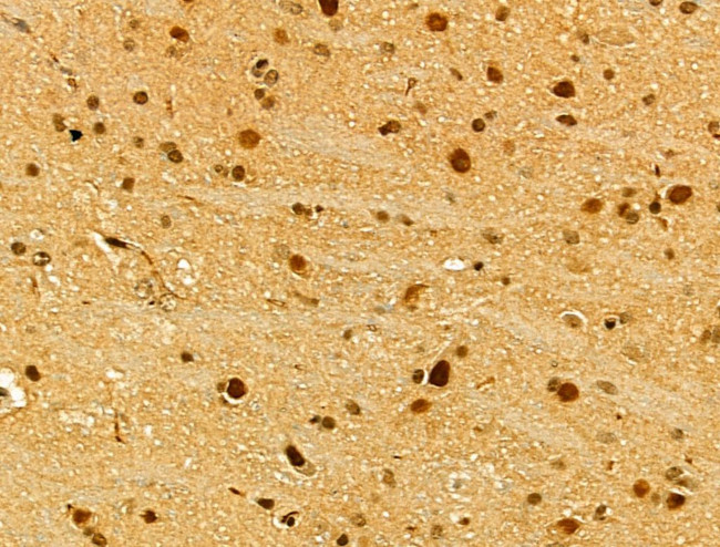 TLE3 Antibody in Immunohistochemistry (Paraffin) (IHC (P))