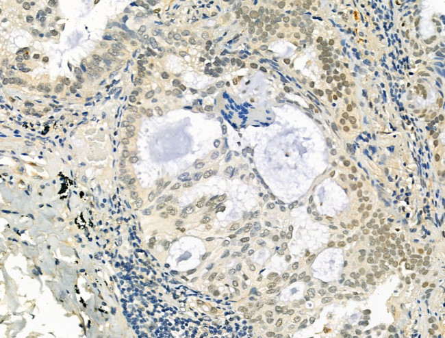 TLE3 Antibody in Immunohistochemistry (Paraffin) (IHC (P))