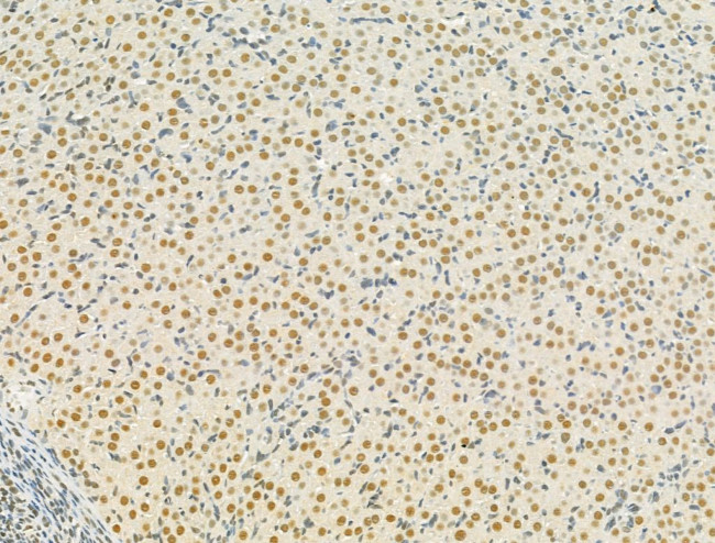 TLE3 Antibody in Immunohistochemistry (Paraffin) (IHC (P))