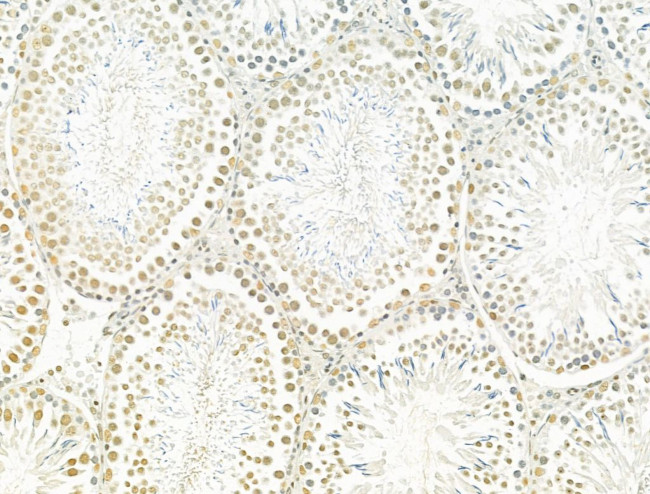 TLE3 Antibody in Immunohistochemistry (Paraffin) (IHC (P))