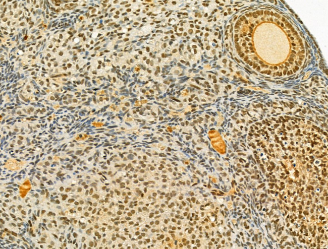 TLE3 Antibody in Immunohistochemistry (Paraffin) (IHC (P))