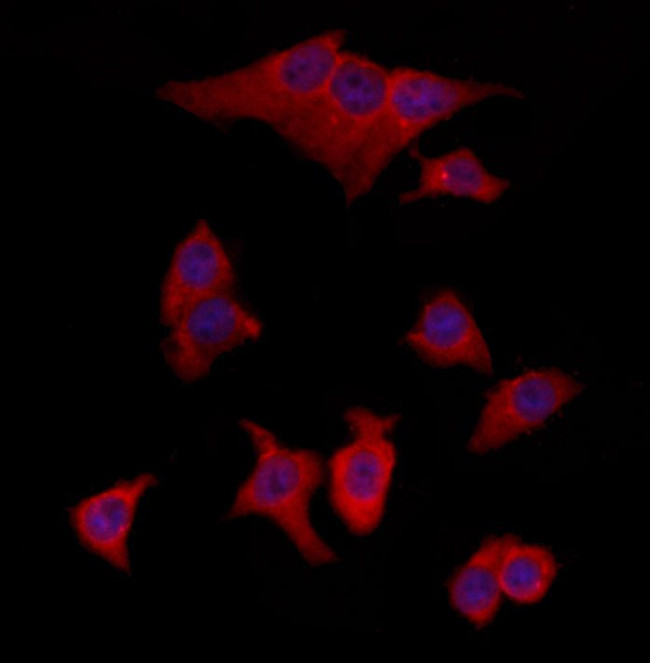 TMOD4 Antibody in Immunocytochemistry (ICC/IF)