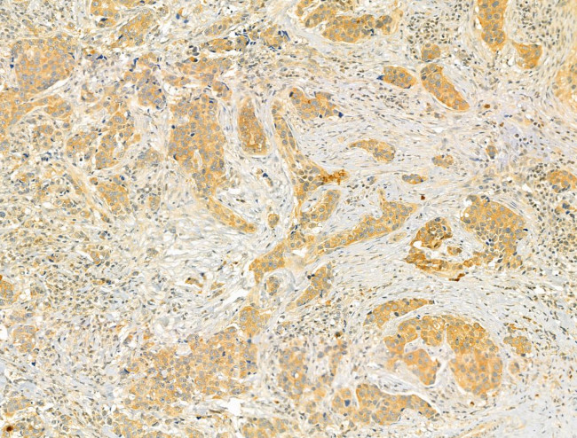 TMOD4 Antibody in Immunohistochemistry (Paraffin) (IHC (P))