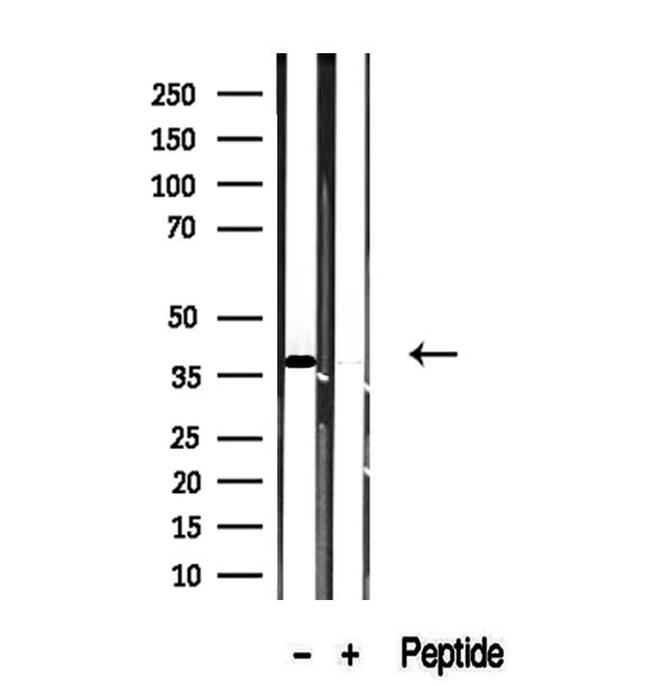 TMOD4 Antibody in Western Blot (WB)