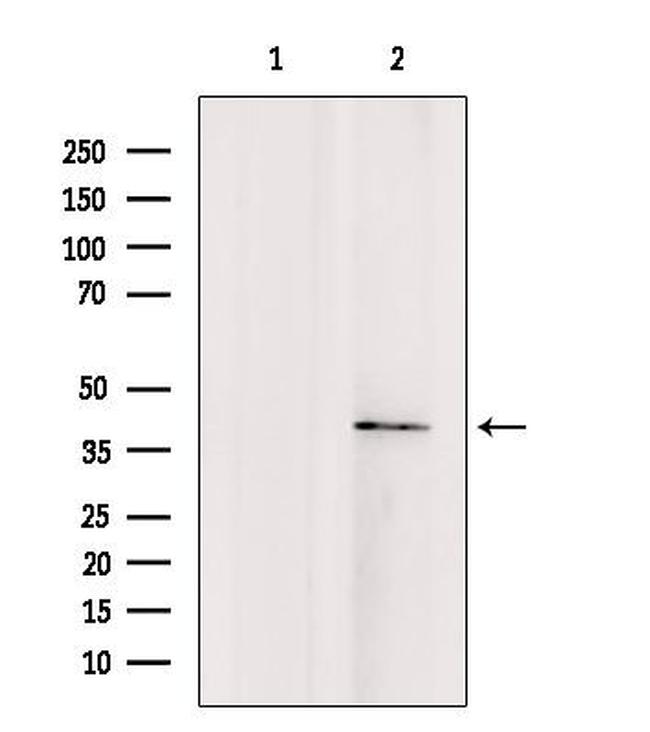 TMOD4 Antibody in Western Blot (WB)