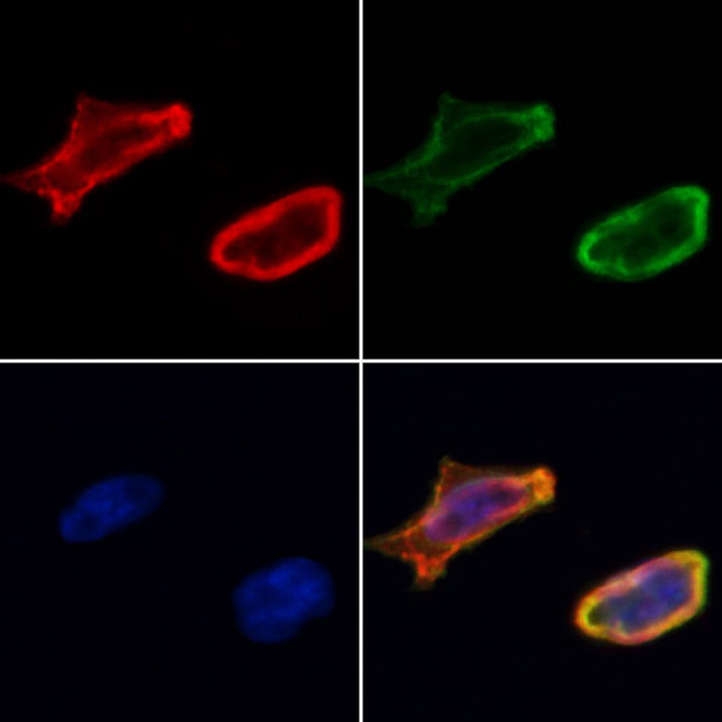 VNN1 Antibody in Immunocytochemistry (ICC/IF)