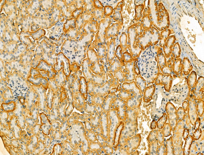 VPS16 Antibody in Immunohistochemistry (Paraffin) (IHC (P))