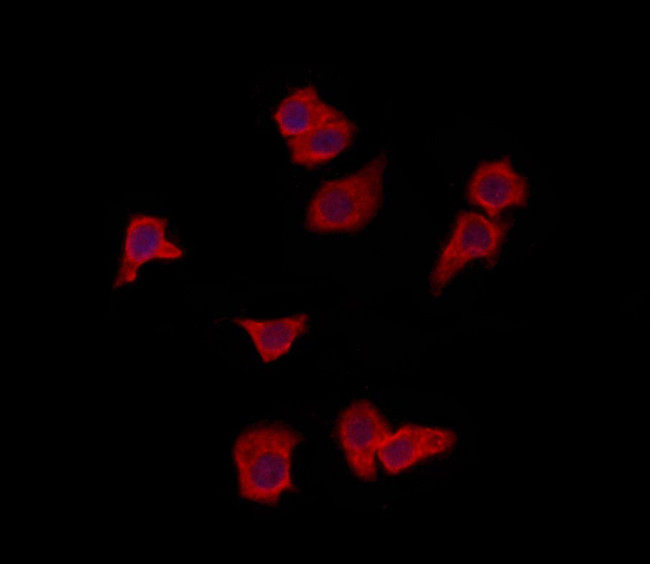 VPS37A Antibody in Immunocytochemistry (ICC/IF)