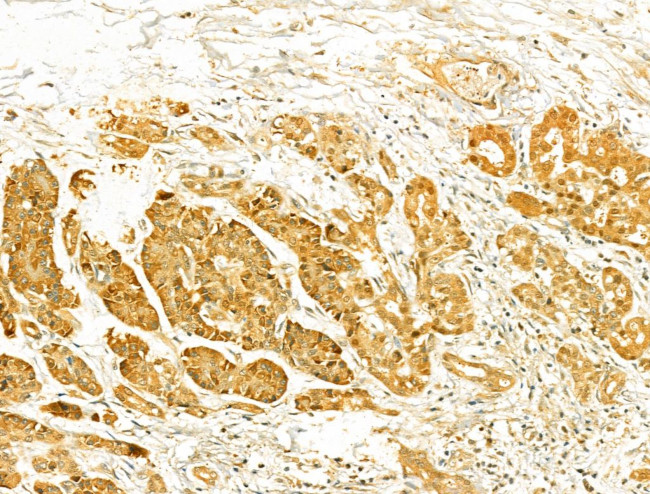 VPS37A Antibody in Immunohistochemistry (Paraffin) (IHC (P))