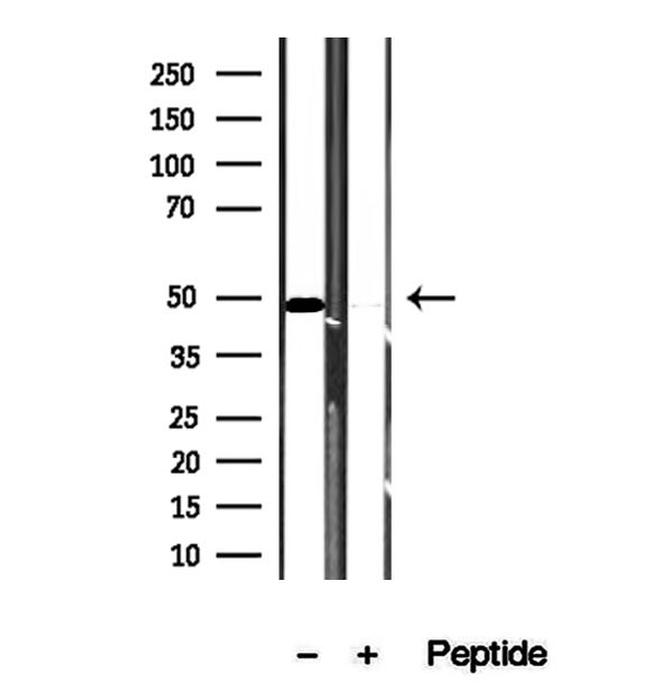 VPS37A Antibody in Western Blot (WB)