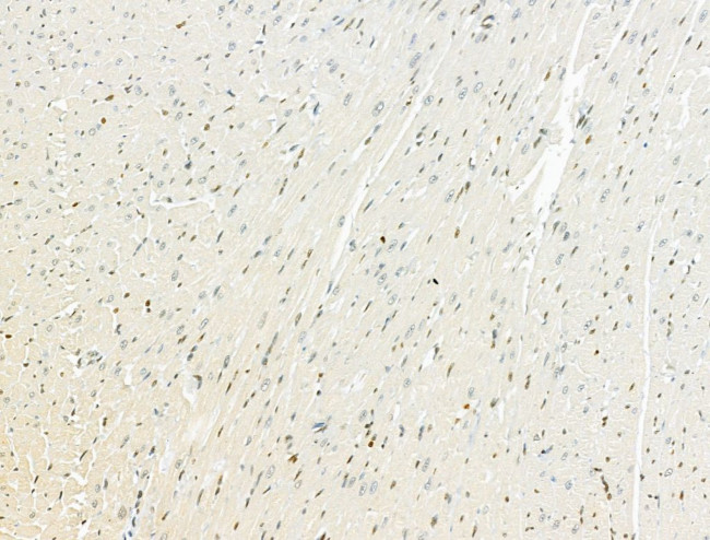 AEBP2 Antibody in Immunohistochemistry (Paraffin) (IHC (P))