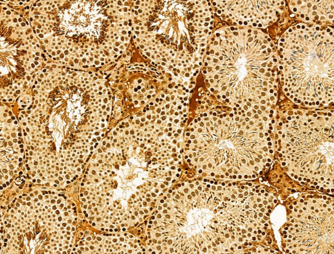 AEBP2 Antibody in Immunohistochemistry (Paraffin) (IHC (P))