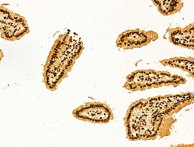 AEBP2 Antibody in Immunohistochemistry (Paraffin) (IHC (P))