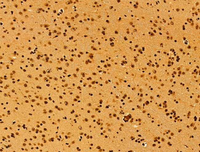 AEBP2 Antibody in Immunohistochemistry (Paraffin) (IHC (P))