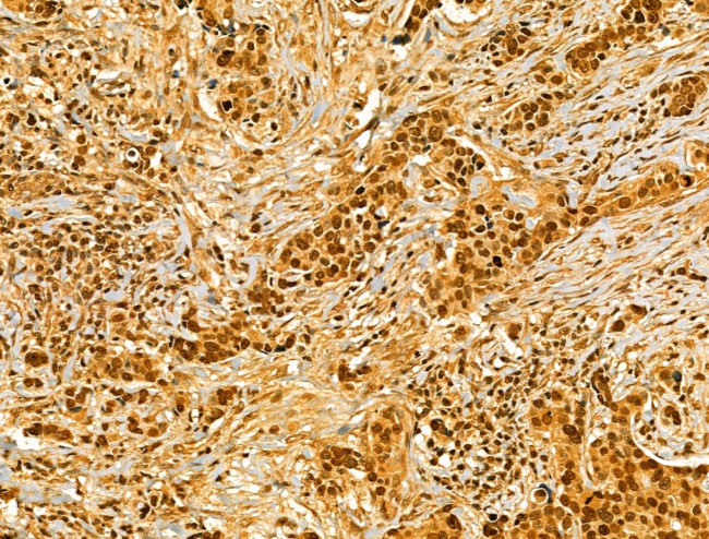 AEBP2 Antibody in Immunohistochemistry (Paraffin) (IHC (P))