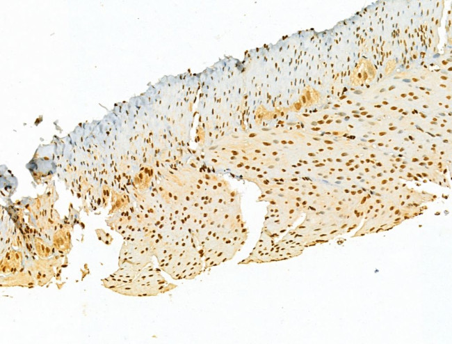 AEBP2 Antibody in Immunohistochemistry (Paraffin) (IHC (P))