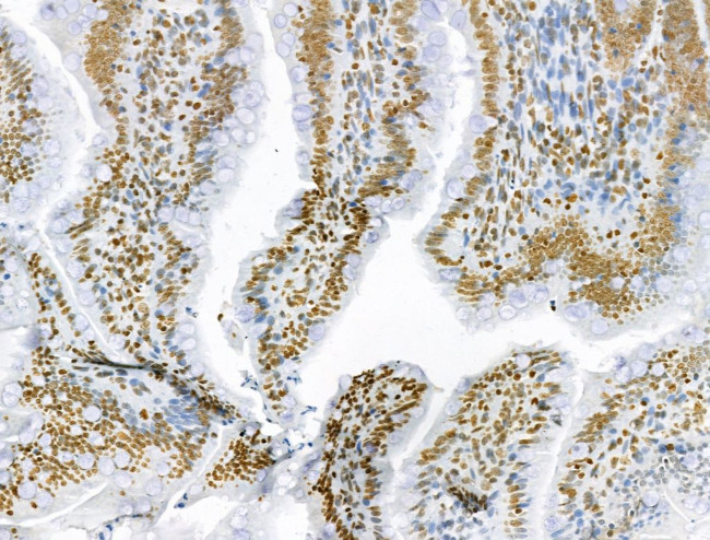 AEBP2 Antibody in Immunohistochemistry (Paraffin) (IHC (P))