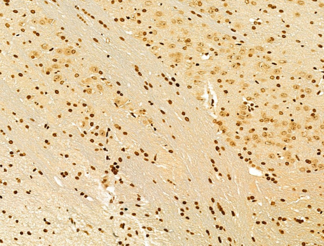 AEBP2 Antibody in Immunohistochemistry (Paraffin) (IHC (P))