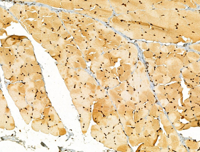 AEBP2 Antibody in Immunohistochemistry (Paraffin) (IHC (P))