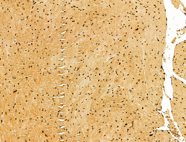 AEBP2 Antibody in Immunohistochemistry (Paraffin) (IHC (P))