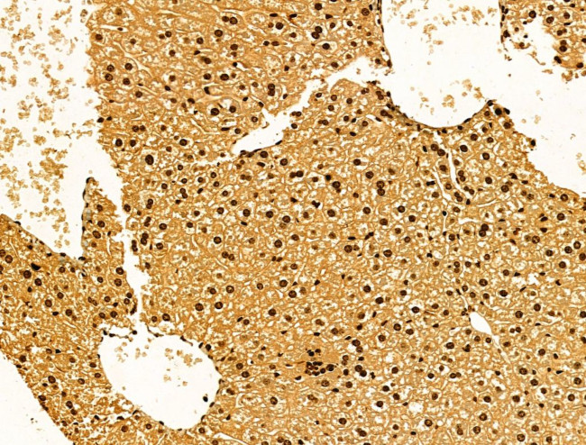 AEBP2 Antibody in Immunohistochemistry (Paraffin) (IHC (P))