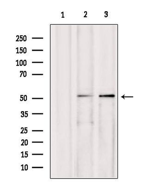 AEBP2 Antibody in Western Blot (WB)