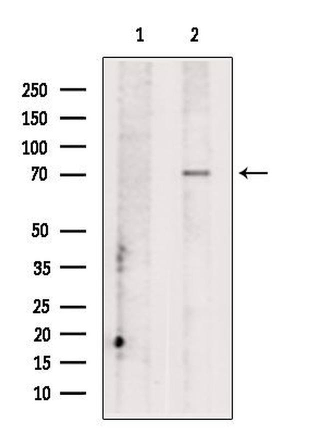 CCDC22 Antibody in Western Blot (WB)