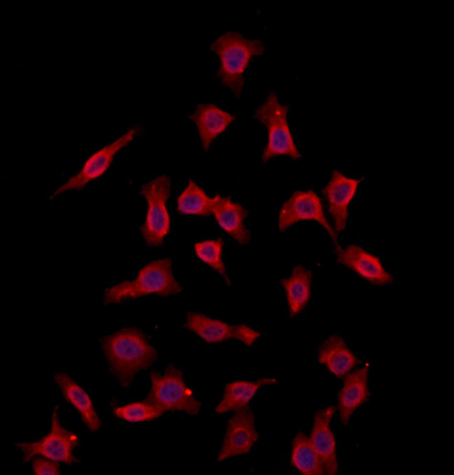 CHMP4B Antibody in Immunocytochemistry (ICC/IF)