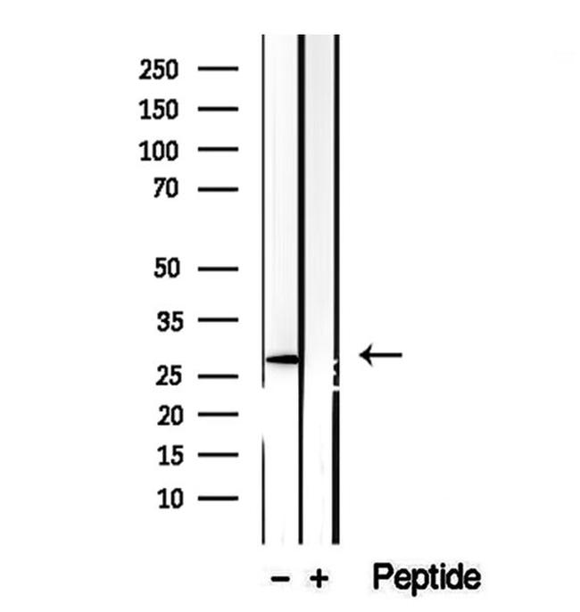 CHMP4B Antibody in Western Blot (WB)