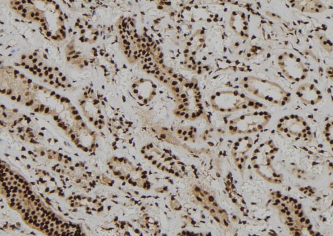 DBR1 Antibody in Immunohistochemistry (Paraffin) (IHC (P))