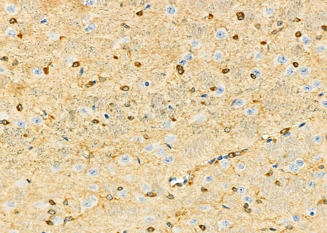 DBR1 Antibody in Immunohistochemistry (Paraffin) (IHC (P))