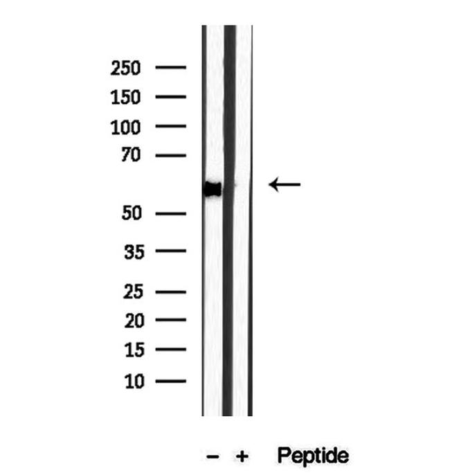 DBR1 Antibody in Western Blot (WB)