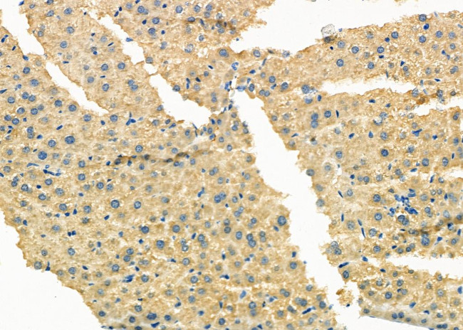 HERPUD1 Antibody in Immunohistochemistry (Paraffin) (IHC (P))