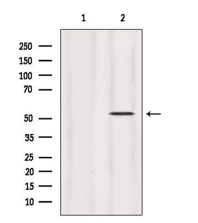 HERPUD1 Antibody in Western Blot (WB)