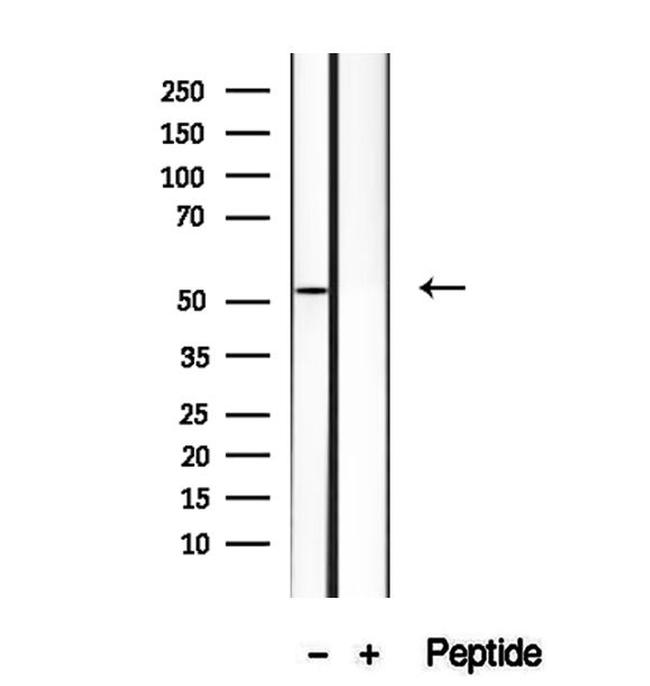 HERPUD1 Antibody in Western Blot (WB)