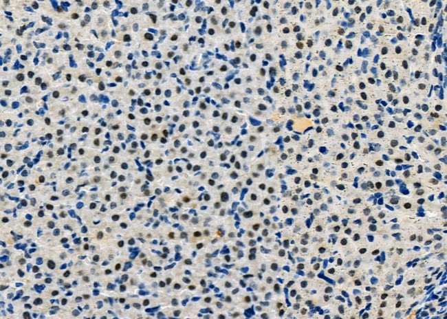 HDGFRP2 Antibody in Immunohistochemistry (Paraffin) (IHC (P))