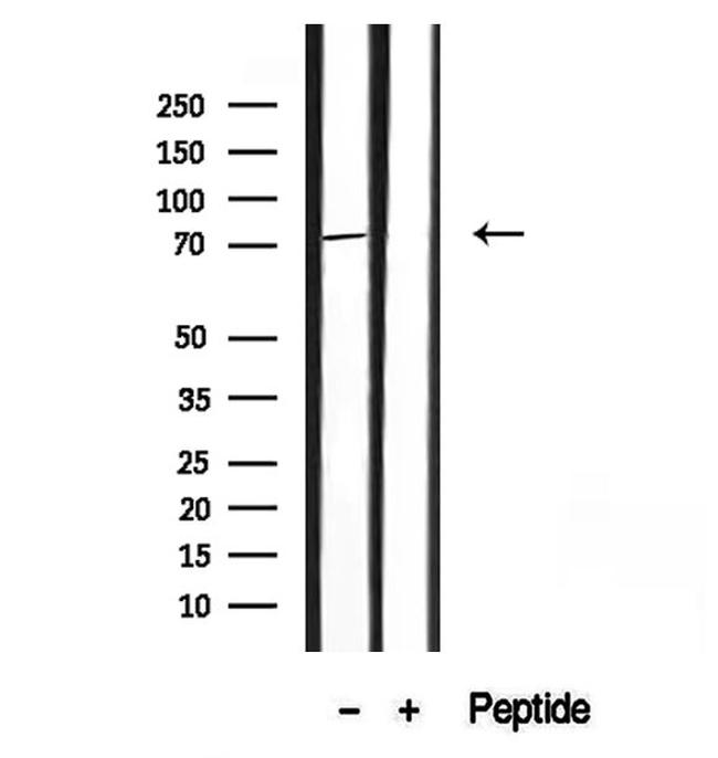 HDGFRP2 Antibody in Western Blot (WB)