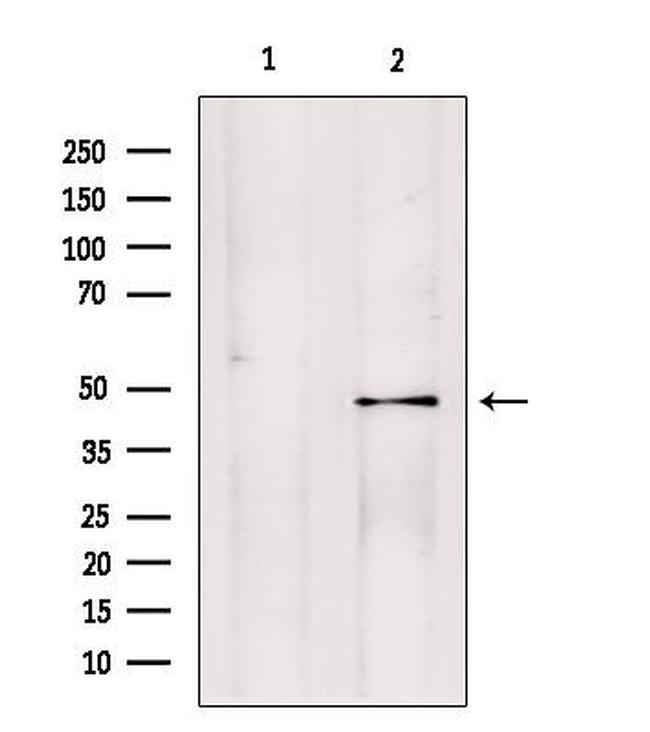 PMPCB Antibody in Western Blot (WB)