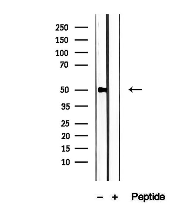 PMPCB Antibody in Western Blot (WB)