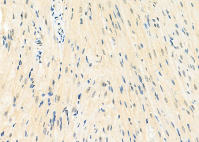 MGRN1 Antibody in Immunohistochemistry (Paraffin) (IHC (P))